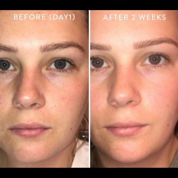 Peach and Lily Glass Skin Refining Serum - Picture 4 of 5